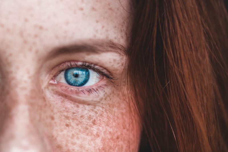 Mulher ruiva com olho azul