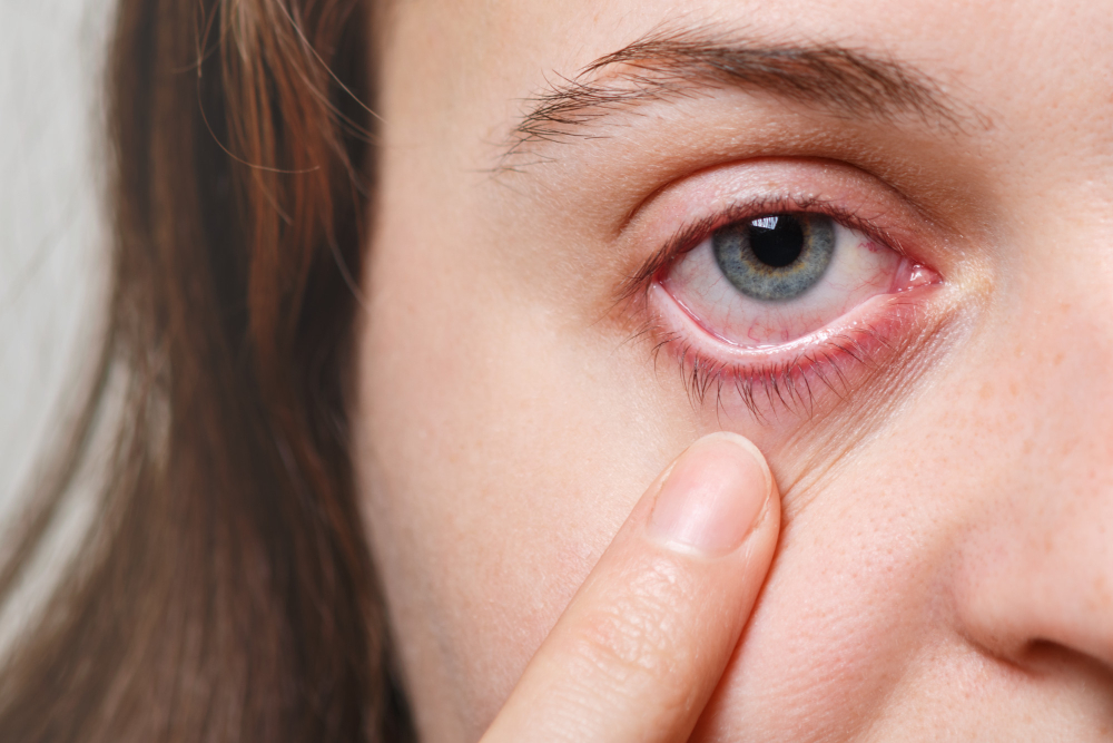 Bactéria no olho: como evitar esse problema?